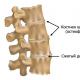 Exercise therapy for cervical osteochondrosis: 16 effective exercises, training rules